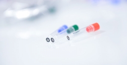 Prothèse de la hanche : chirurgie de précision