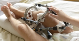 Pour que tous les enfants marchent – Marche DMD